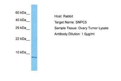 SNAPC5 Rabbit anti-Human, Polyclonal, Novus Biologicals 100 &mu;g; Unconjugated:Antibodies,